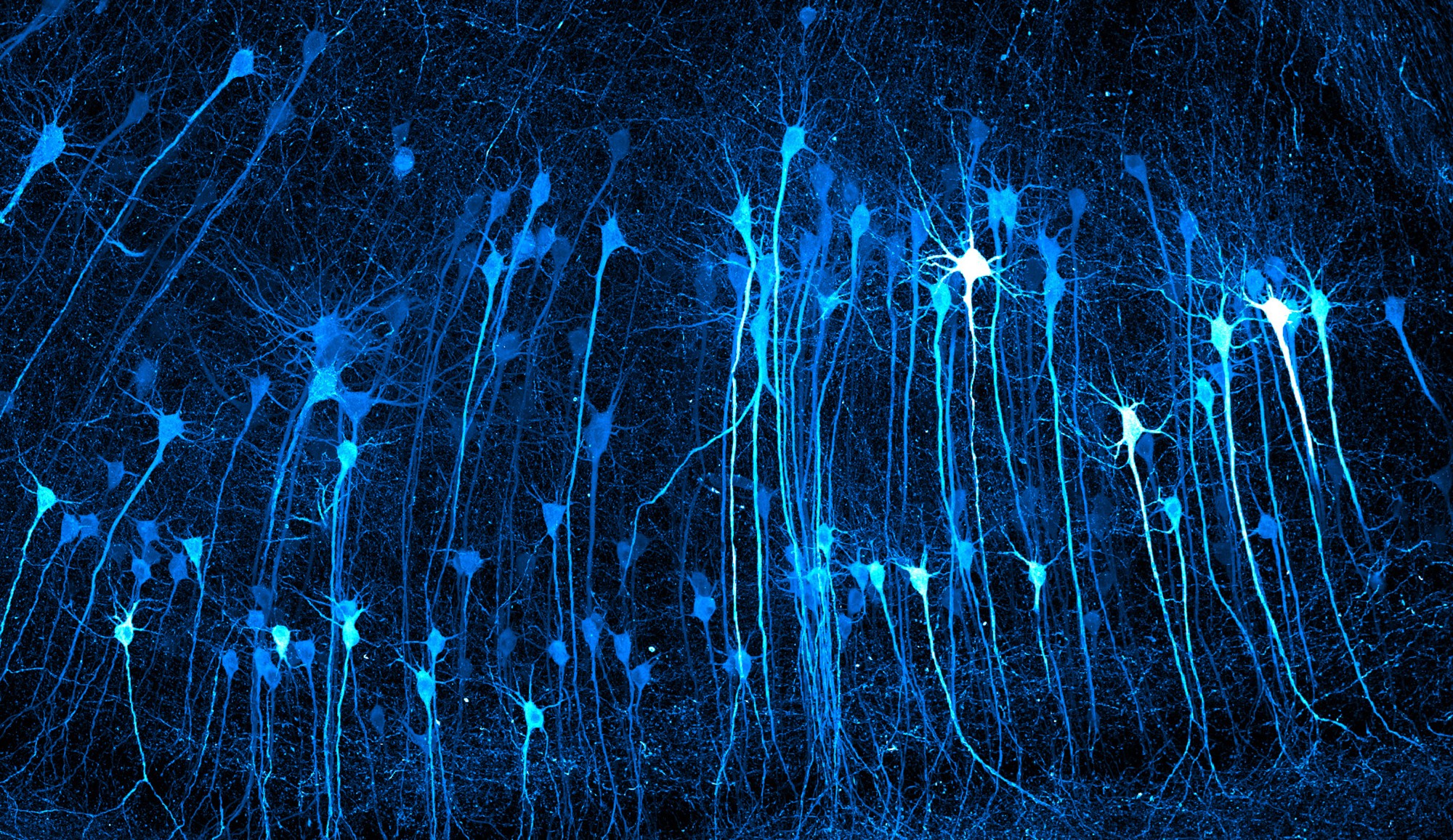 A microscopic view of long, parallel neurons in a mouse brain, looking like loose columns or bits of hanging string