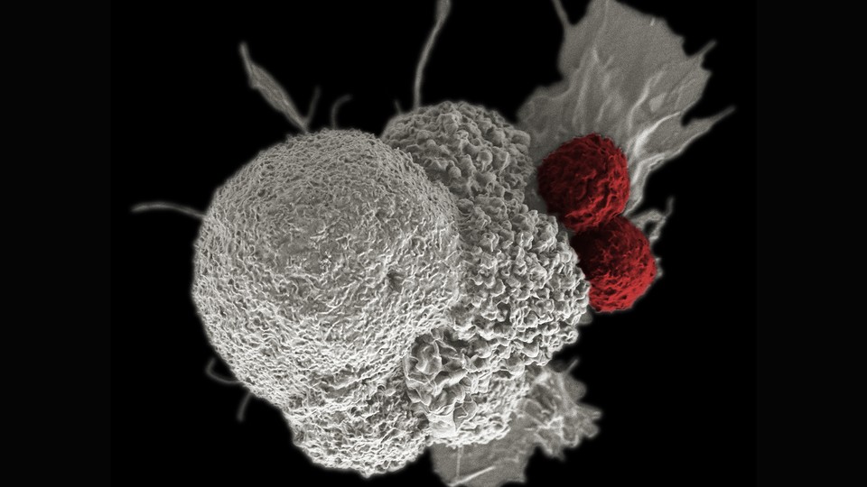 One large white cancer cell being attacked by two smaller red T cells 