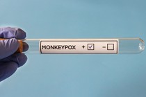 An empty vial marked "Monkeypox," with a + and - box.