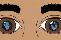 Eyes with Trichoplax in the pupils