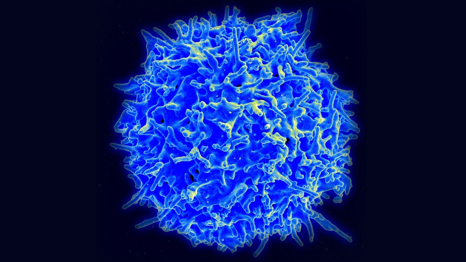 Scanning electron micrograph of a T cell, colored blue