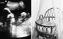 An ultrasound image and a photo of an empty cradle