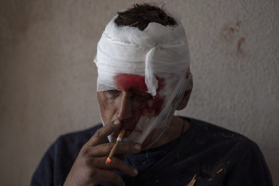 An injured man with a bandage wrapped around his head smokes a cigarette.