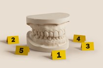 An illustration showing a dental plaster surrounded by evidence markers