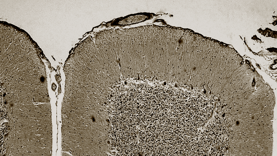 An image of the cerebellum