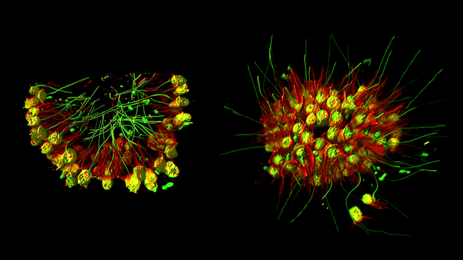 Photograph of the C. flexa Choanoflagellates.