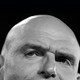 A tightly cropped photo of John Fetterman's head.