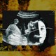 a woman's face and fetus against a backdrop of buildings blown up in the attack on ukraine