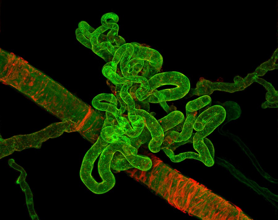 A microscopic view of a tiny tangled blood vessel