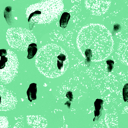 Some black smudges on a green background with white blobs