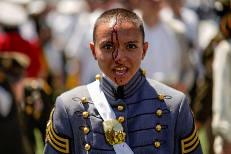 A person in a dress uniform looks toward the camera with dried blood on their face from a cut on their head.