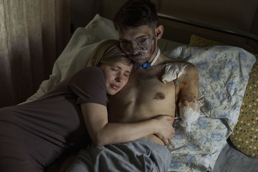 A woman lies in a bed, hugging her injured husband, who still wears bandages, with visible wounds across his face and upper body.
