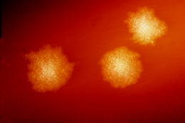 After Antibiotics The Feces Pill Remains The Atlantic