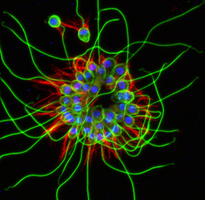 A photograph of a colony of B. monosierra choanoflagellates.