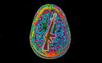 An illustration of a brain scan, with the outline of a gun visible in the brain