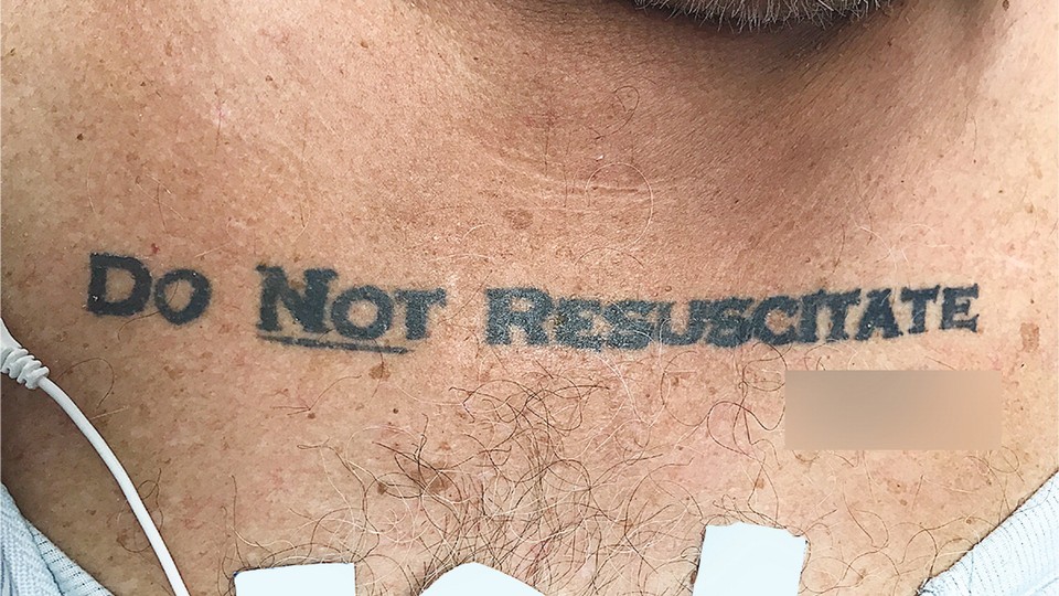 A man with a Do Not Resuscitate tattoo. The signature was blurred out by his medical team. 