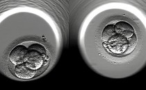 Embryos IVF