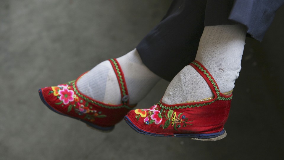 Feet distorted by foot-binding