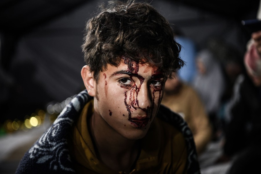 A young man with dried blood on his face looks toward the camera.
