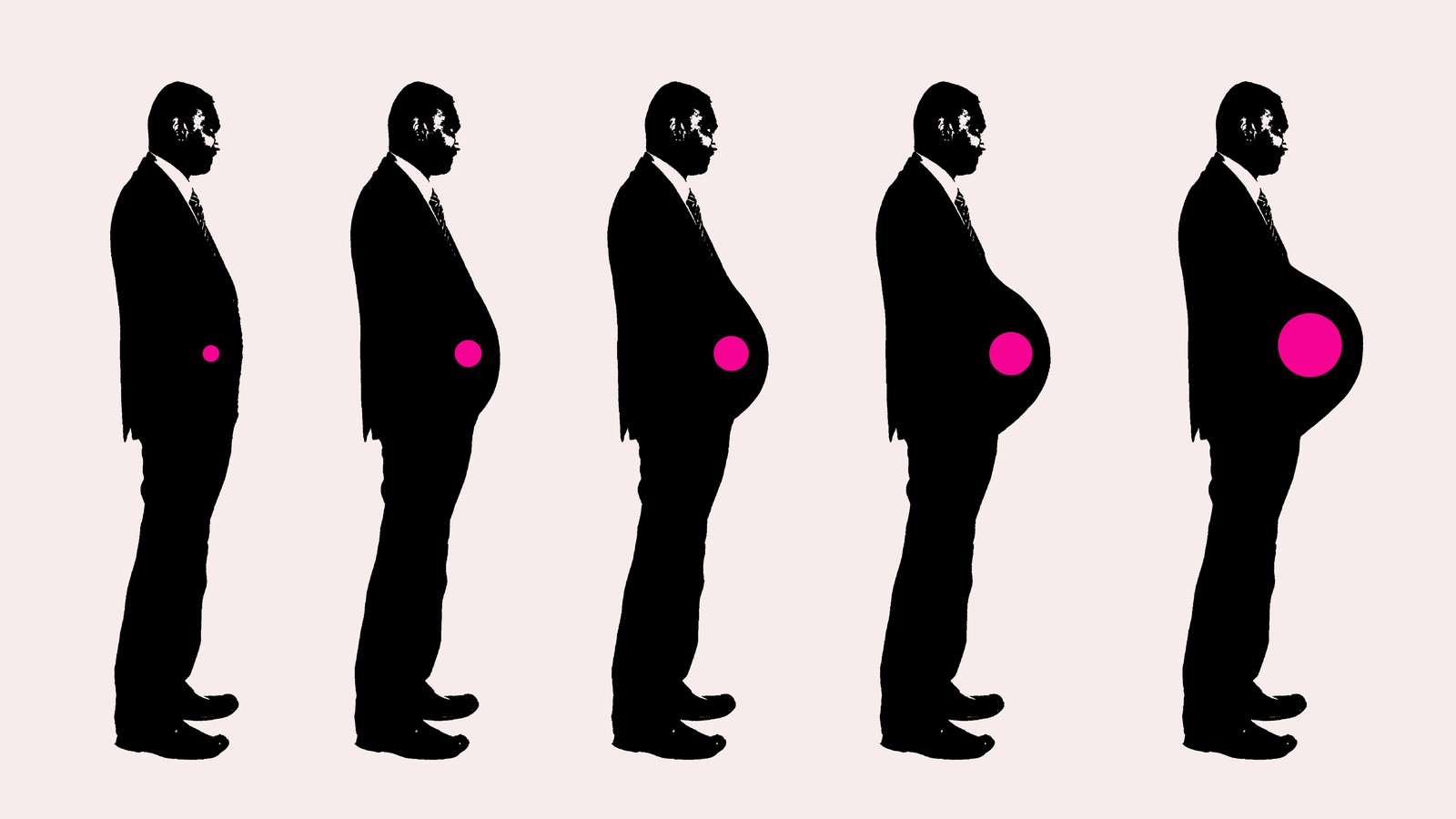 Fake pregnancy belly -  France