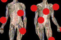 Illustration of two human bodies with red dots overlaid.