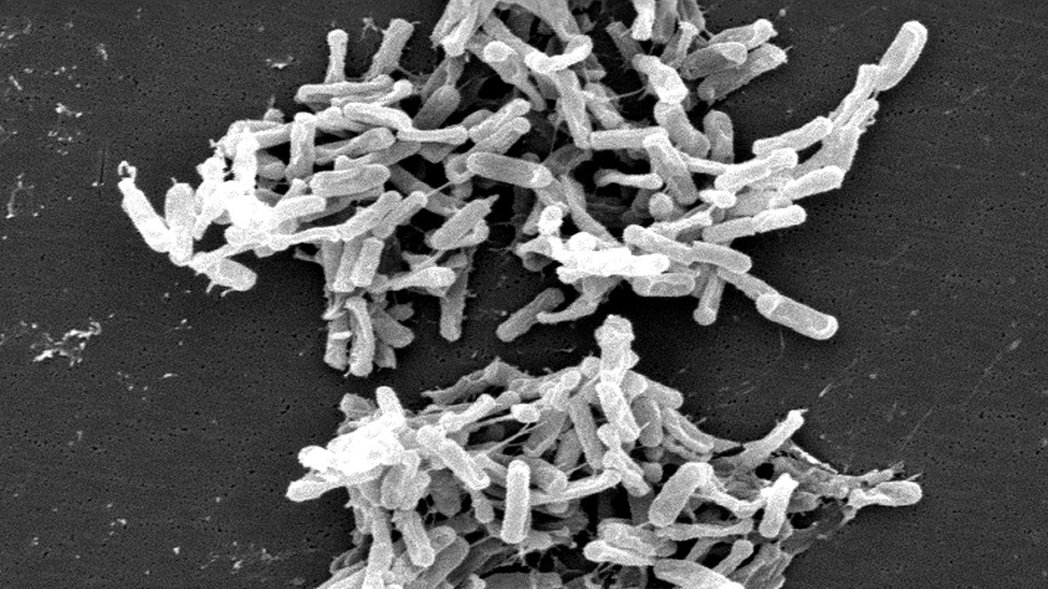 A microscopic shot of the bacteria that cause C. diff